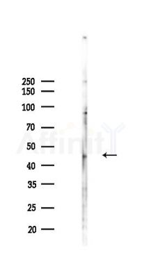 Phospho-E2F1 (Thr433) Antibody - Western blot analysis of lysates from PC12 cells(UV,30min treatment), using Phospho-E2F1 (Thr433) Antibody at 1/1000 dilution.