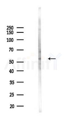 Phospho-RUNX1 / AML1 (Ser304) Antibody - Western blot analysis of lysates from HUVEC cells(UV,30min treatment), using Phospho-RUNX1 / AML1 (Ser304) Antibody at 1/1000 dilution.