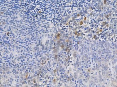 Phospho-MEF2A (Thr312) Antibody - AF3381 at 1/100 staining human normal tonsil tissue by IHC-P.