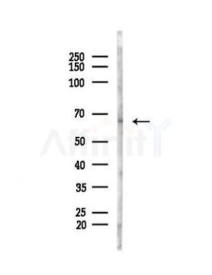 Phospho-NF-kB p65 (Ser276) Antibody - Western blot analysis of lysates from Hela cells(heat-shock, 45min treatment), using Phospho-NF-kB p65 (Ser276) Antibody at 1/1000 dilution.