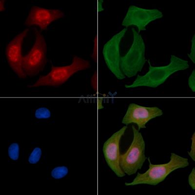 Phospho-NF-kB p65 (Thr254) Antibody - AF3391 staining Hela cells by IF/ICC.