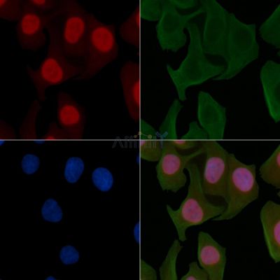Phospho-NF-kB p65 (Ser281) Antibody - AF3393 staining Hela cells by IF/ICC.