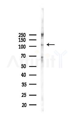 Phospho-FAK (Tyr925) Antibody - Western blot analysis of lysates from K562 cells(heat-shock,45min treatment), using Phospho-FAK (Tyr925) Antibody at 1/1000 dilution.
