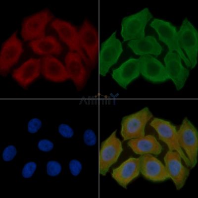 Phospho-HSL (Ser855/Ser554) Antibody - AF3402 staining Hela cells(30min of UV treatment) by IF/ICC.