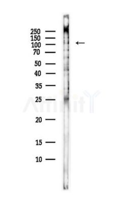 Phospho-HSL (Ser552) Antibody - Western blot analysis of lysates from Hela cells(starvation,24h treatment), using Phospho-HSL (Ser552) Antibody at 1/1000 dilution.