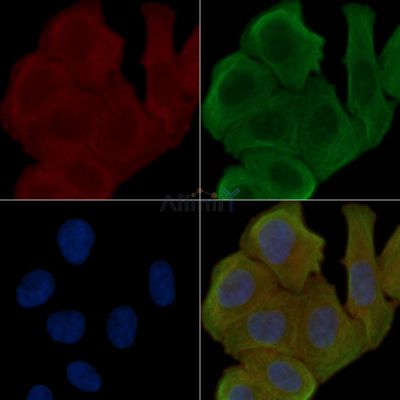Phospho-PKC delta (Tyr313) Antibody - AF3409 staining Hela cells(30min of UV treatment) by IF/ICC.