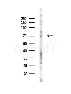 Phospho-FOXO1A (Ser319) Antibody - Western blot analysis of lysates from PC12 cells(UV,30min treatment), using Phospho-FOXO1A (Ser319) Antibody at 1/1000 dilution.