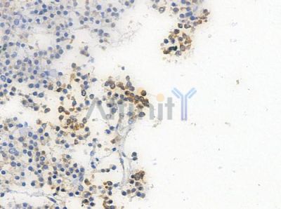 Phospho-pan-FOXO1/3/4 (Thr24/Thr32) Antibody - AF3419 at 1/100 staining human pituitary adenoma by IHC-P.