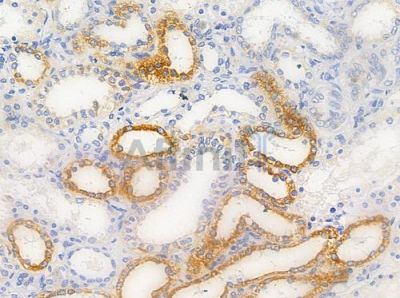 Phospho-pan-FOXO1/3/4 (Thr24/Thr32) Antibody - AF3419 at 1/100 staining human normal kidney tissue by IHC-P.