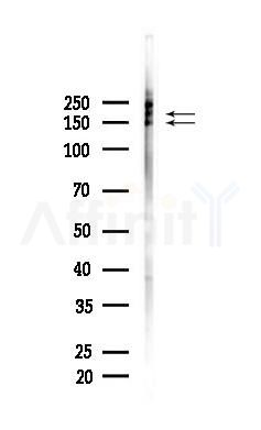 Phospho-NMDAR2B (Tyr1336) Antibody - Western blot analysis of lysates from COLO205 cells(heat-shock,45min treatment), using Phospho-NMDAR2B (Tyr1336) Antibody at 1/1000 dilution.