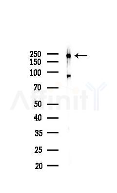 Phospho-TRAP220/MED1 (Thr1457) Antibody - Western blot analysis of lysates from K562 cells(heat-shock,45min treatment), using Phospho-TRAP220/MED1 (Thr1457) Antibody at 1/1000 dilution.