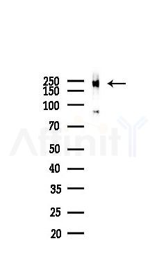 Phospho-TRAP220/MED1 (Thr1457) Antibody - Western blot analysis of lysates from COLO205 cells(heat-shock,45min treatment), using Phospho-TRAP220/MED1 (Thr1457) Antibody at 1/1000 dilution.