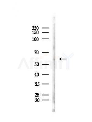 Phospho-Smad1 (Ser465) Antibody - Western blot analysis of lysates from Hela cells(heat-shock, 45min treatment), using Phospho-Smad1 (Ser465) Antibody at 1/1000 dilution.