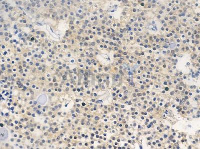 Phospho-CDC37 (Ser13) Antibody - AF3458 at 1/100 staining human pituitary adenoma by IHC-P.