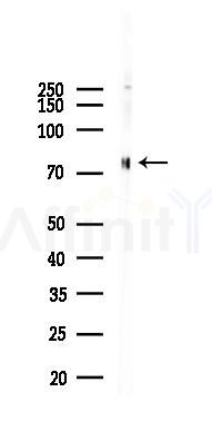 Phospho-SAMHD1 (Thr592) Antibody - Western blot analysis of lysates from 293 cells(UV,30min treatment), using Phospho-SAMHD1 (Thr592) Antibody at 1/1000 dilution.