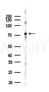 Phospho-SAMHD1 (Thr592) Antibody - Western blot analysis of lysates from EC304 cells(UV,30min treatment), using Phospho-SAMHD1 (Thr592) Antibody at 1/1000 dilution.