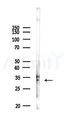 Phospho-Calsenilin/KCNIP3 (Ser63) Antibody - Western blot analysis of lysates from PC12 cells, using Phospho-Calsenilin/KCNIP3 (Ser63) Antibody at 1/1000 dilution.