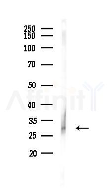 Phospho-TMS1/ASC (Ser195) Antibody - Western blot analysis of lysates from Mouse liver, using Phospho-TMS1/ASC (Ser195) Antibody at 1/1000 dilution.