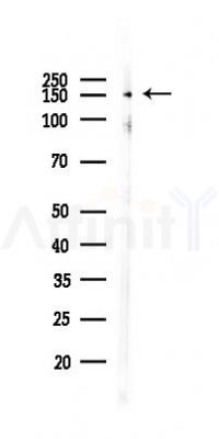 Phospho-TAO2 (Ser181) Antibody - Western blot analysis of lysates from 293 cells(UV,30min treatment), using Phospho-TAO2 (Ser181) Antibody at 1/1000 dilution.