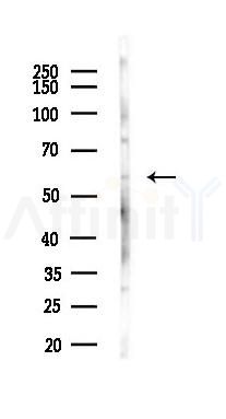 Phospho-STK39 (Ser311) Antibody - Western blot analysis of lysates from Mouse liver, using Phospho-STK39 (Ser311) Antibody at 1/1000 dilution.