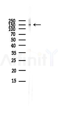 Phospho-PERK (Ser715) Antibody - Western blot analysis of lysates from HUVEC cells(LPS,4h treatment), using Phospho-PERK (Ser715) Antibody at 1/1000 dilution.