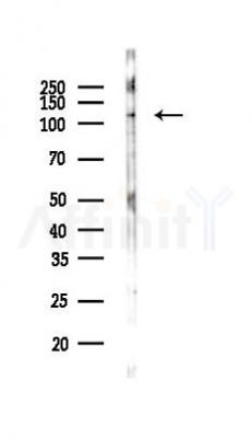 Phospho-SIK2 (Thr484) Antibody - Western blot analysis of lysates from MCF7 cells, using Phospho-SIK2 (Thr484) Antibody at 1/1000 dilution.