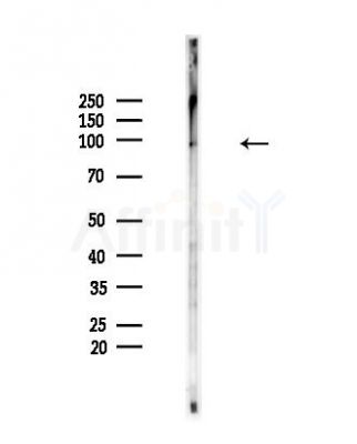 Phospho-UHRF1 (Ser311) Antibody - Western blot analysis of lysates from Mouse brain, using Phospho-UHRF1 (Ser311) Antibody at 1/1000 dilution.
