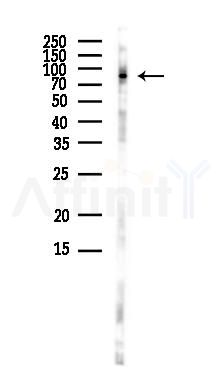 Phospho-NLRP3 (Ser194) Antibody - Western blot analysis of lysates from Rat brain, using Phospho-NLRP3 (Ser194) Antibody at 1/1000 dilution.