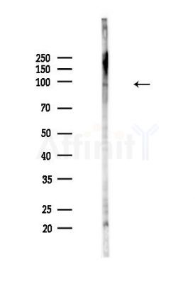 Phospho-TrkC (Tyr516) Antibody - Western blot analysis of lysates from Hela cells(heat-shock,45min treatment), using Phospho-TrkC (Tyr516) Antibody at 1/1000 dilution.