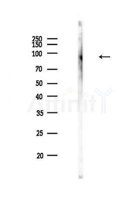 Phospho-EZH2 (Ser311) Antibody - Western blot analysis of lysates from MCF7 cells, using Phospho-EZH2 (Ser311) Antibody at 1/1000 dilution.