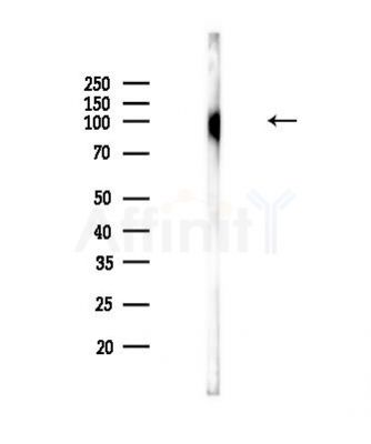 Phospho-EZH2 (Ser311) Antibody - Western blot analysis of lysates from Rat lung, using Phospho-EZH2 (Ser311) Antibody at 1/1000 dilution.