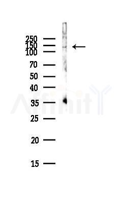 Phospho-NFAT3 (Ser676) Antibody - Western blot analysis of lysates from PC12 cells(LPS,4h treatment), using Phospho-NFAT3 (Ser676) Antibody at 1/1000 dilution.