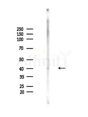 Phospho-Kir6.2 (Thr224) Antibody - Western blot analysis of lysates from Mouse brain, using Phospho-Kir6.