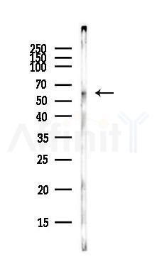 Phospho-IRF5 (Ser446) Antibody - Western blot analysis of lysates from PC12 cells(LPS,4h treatment), using Phospho-IRF5 (Ser446) Antibody at 1/1000 dilution.