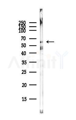 Phospho-IRF5 (Ser446) Antibody - Western blot analysis of lysates from COLO205 cells(heat-shock,45min treatment), using Phospho-IRF5 (Ser446) Antibody at 1/1000 dilution.