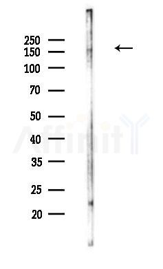 Phospho-NMDAR2A (Ser1155) Antibody - Western blot analysis of lysates from Hela cells(heat-shock,45min treatment), using Phospho-NMDAR2A (Ser1155) Antibody at 1/1000 dilution.