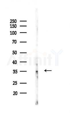 Phospho-RAD51 (Tyr54) Antibody - Western blot analysis of lysates from Mouse lung, using Phospho-RAD51 (Tyr54) Antibody at 1/1000 dilution.