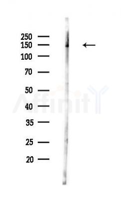 Phospho-RON (Ser1394) Antibody - Western blot analysis of lysates from Mouse lung, using Phospho-RON (Ser1394) Antibody at 1/1000 dilution.