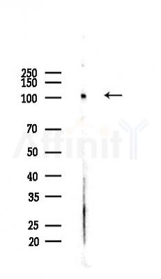 Phospho-SRPK2 (Ser494/Ser497) Antibody - Western blot analysis of lysates from Hela cells(heat-shock,45min treatment), using Phospho-SRPK2 (Ser494/Ser497) Antibody at 1/1000 dilution.