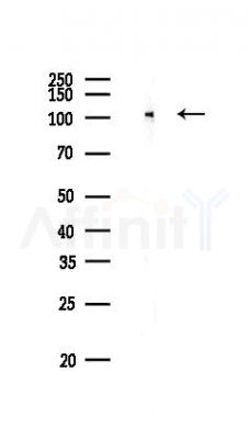 Phospho-SRPK2 (Ser494/Ser497) Antibody - Western blot analysis of lysates from B16F10-LUC cells, using Phospho-SRPK2 (Ser494/Ser497) Antibody at 1/1000 dilution.