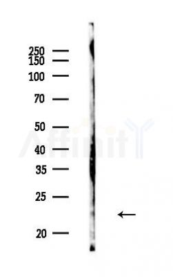 Phospho-Rab8 (Thr72) Antibody - Western blot analysis of lysates from B16F10-LUC cells, using Phospho-Rab8 (Thr72) Antibody at 1/1000 dilution.
