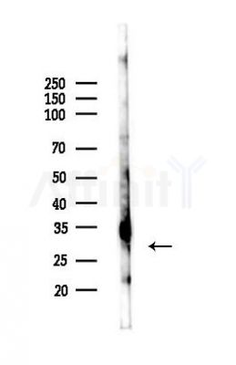 Phospho-SNAP25 (Ser187) Antibody - Western blot analysis of lysates from PC12 cells, using Phospho-SNAP25 (Ser187) Antibody at 1/1000 dilution.