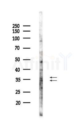 Phospho-TIRAP (Tyr86) Antibody - Western blot analysis of lysates from Mouse lung, using Phospho-TIRAP (Tyr86) Antibody at 1/1000 dilution.