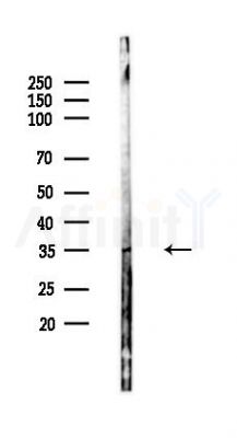Phospho-TIRAP (Tyr86) Antibody - Western blot analysis of lysates from PC12 cells, using Phospho-TIRAP (Tyr86) Antibody at 1/1000 dilution.