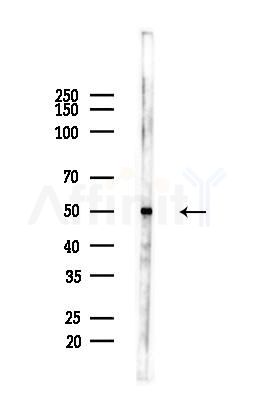 Phospho-FOXL2 (Ser263) Antibody - Western blot analysis of lysates from Hela cells(heat-shock,45min treatment), using Phospho-FOXL2 (Ser263) Antibody at 1/1000 dilution.