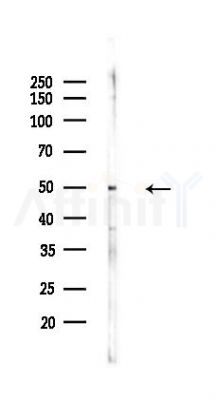 Phospho-FOXL2 (Ser263) Antibody - Western blot analysis of lysates from Mouse lung, using Phospho-FOXL2 (Ser263) Antibody at 1/1000 dilution.