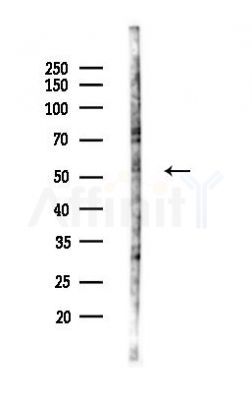 Phospho-BACE1 (Thr252) Antibody - Western blot analysis of lysates from Mouse lung, using Phospho-BACE1 (Thr252) Antibody at 1/1000 dilution.