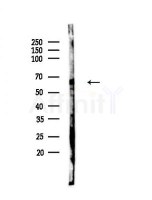 Phospho-BACE1 (Thr252) Antibody - Western blot analysis of lysates from PC12 cells, using Phospho-BACE1 (Thr252) Antibody at 1/1000 dilution.