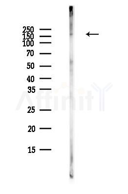 Phospho-IRS1 (Tyr612) Antibody - Western blot analysis of lysates from MCF7 cells(heat-shock,45min treatment), using Phospho-IRS1 (Tyr612) Antibody at 1/1000 dilution.