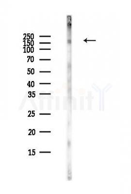 Phospho-IRS1 (Tyr612) Antibody - Western blot analysis of lysates from COLO205 cells(heat-shock,45min treatment), using Phospho-IRS1 (Tyr612) Antibody at 1/1000 dilution.
